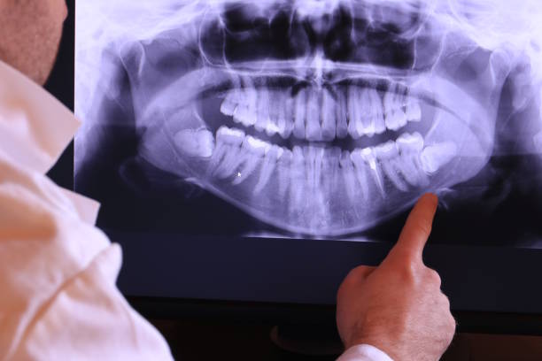 Best Same-Day Emergency Dentist in Beechwood, MI