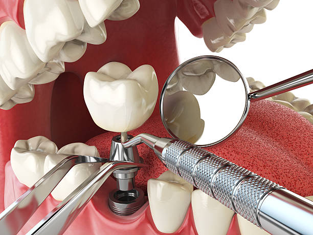 Best Weekend Emergency Dentist in Beechwood, MI